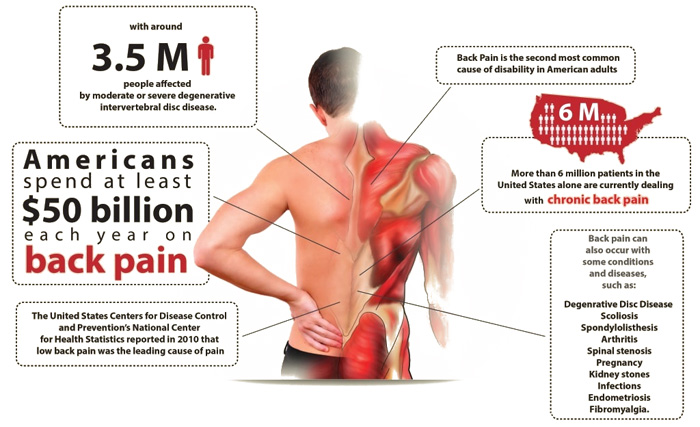 Three Types of Back Pain: How to Treat the Hurt